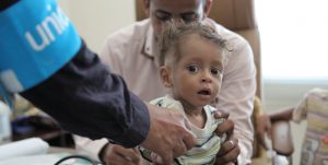 A young child is assessed for malnutrition at a UNICEF supported clinic in Yemen.