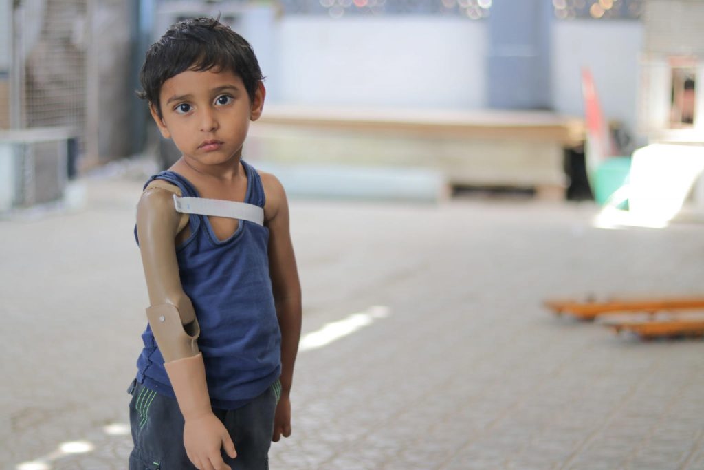 yemen boy with prosthetic arm