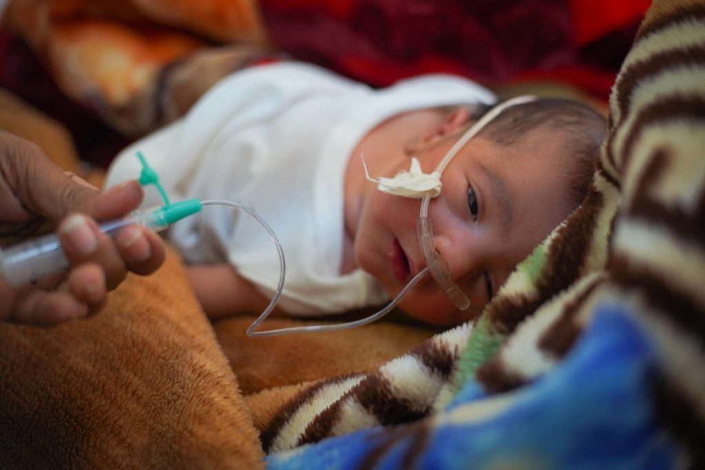 malnourished child yemen