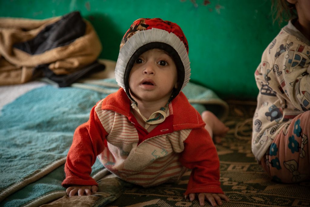 malnourished child crawling on floor