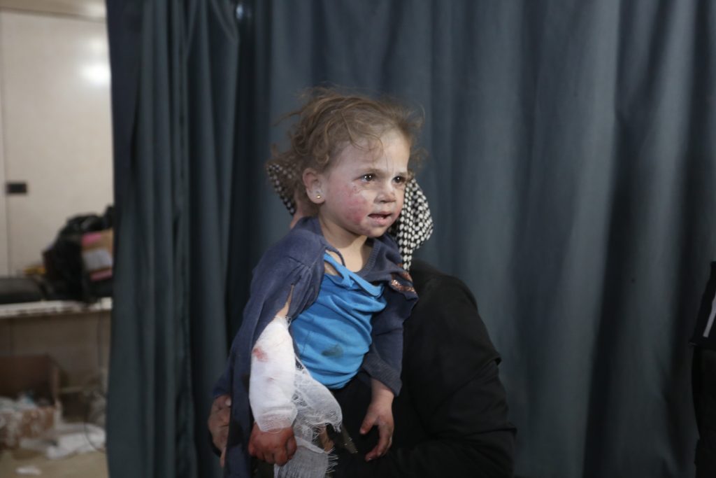 injured girl syria