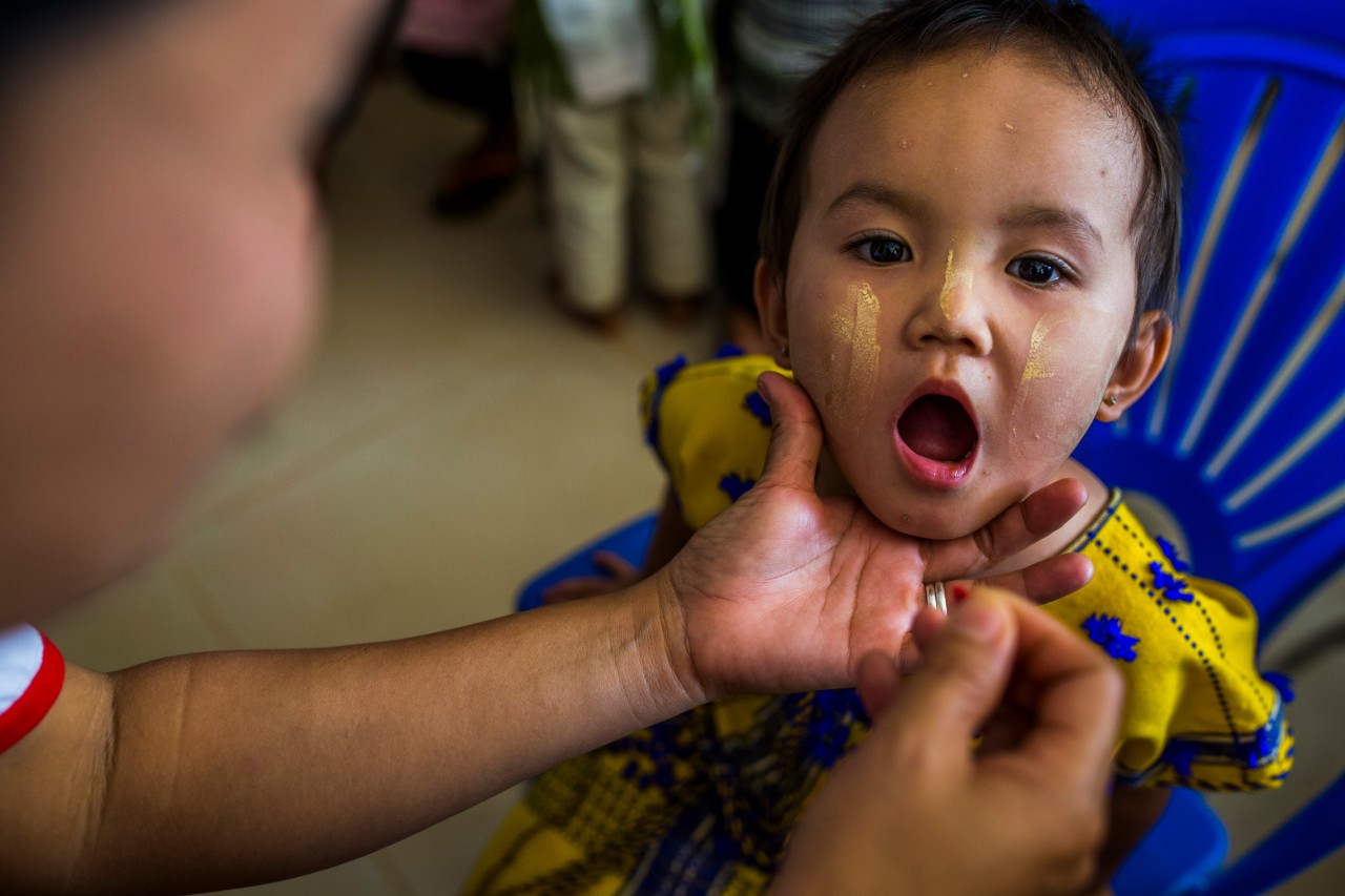 Children in Myanmar recieve Vitamin A supplementation 