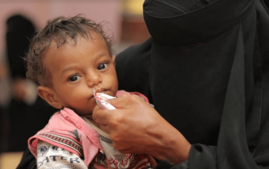 yemeni child eats peanut paste