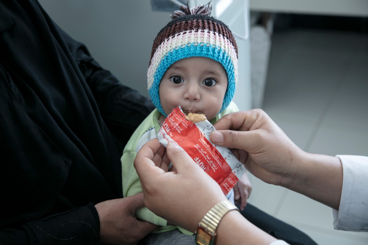 A young child eats therapeutic food - peanut paste at a UNICEF supported health center in Yemen