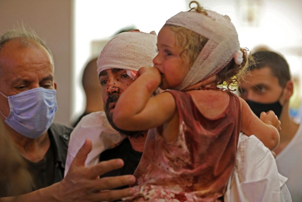 father holding injured girl beirut