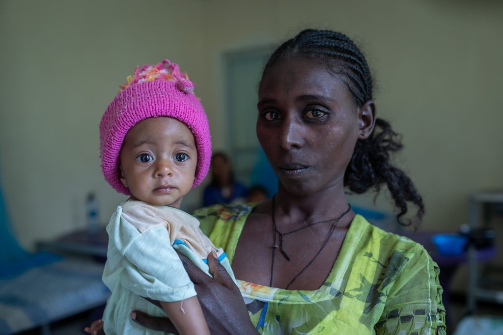 malnourished child in her mothers arms