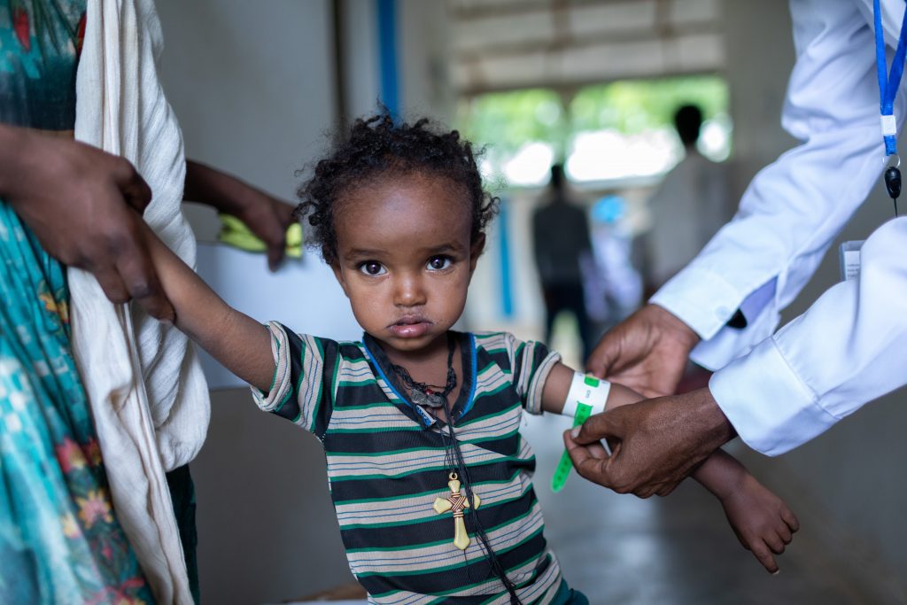 child being examined for malnutrition