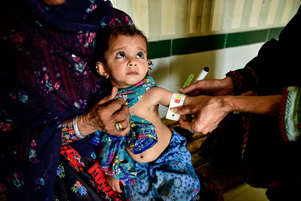 child being screen for malnutrition