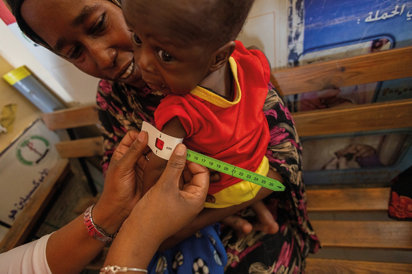 The situation for children like Umran is desperately urgent. Yet even severe acute malnutrition is preventable and treatable. But we have to be quick. Donate to children in Sudan