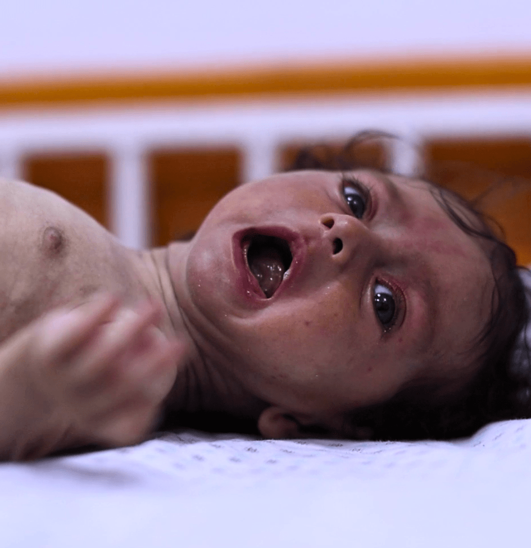 Thousands of children in Gaza just like Baraa are starving and on the brink of death – they need your help today.