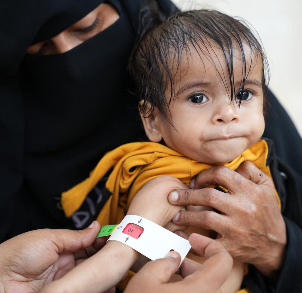 Half of all children in Yemen are not getting enough food – they are at risk from deadly diseases and permanent, long-term damage without urgent help.
