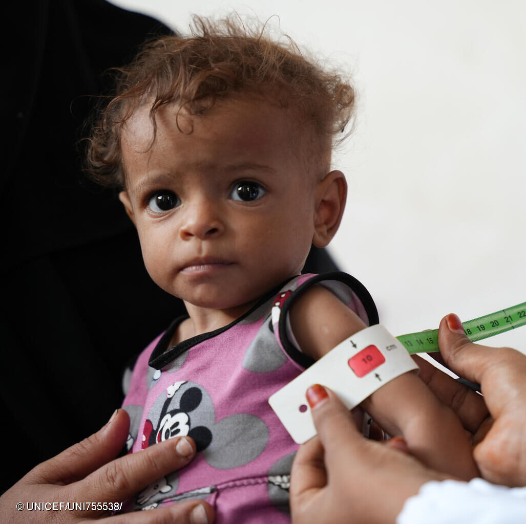UNICEF staff measure Kiara’s arm circumference, which shows she has a deadly form of malnutrition and will need consistent support for months to come.