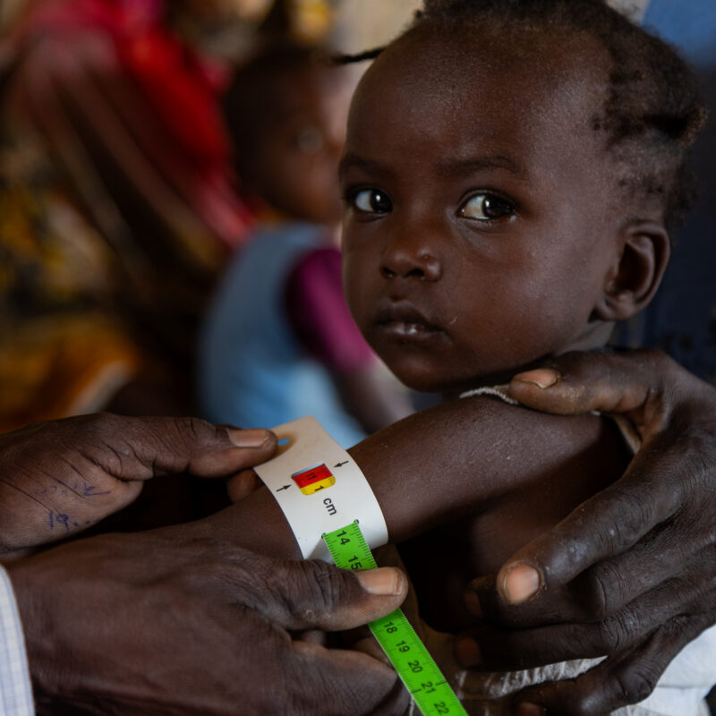 One of thousands of malnourished children in Sudan who have received help from supporters like you. 