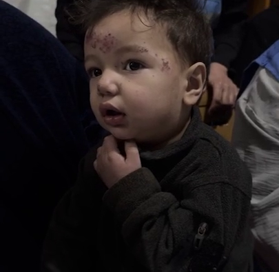 A child in Gaza amid diseases caused by unsafe water in Palestine