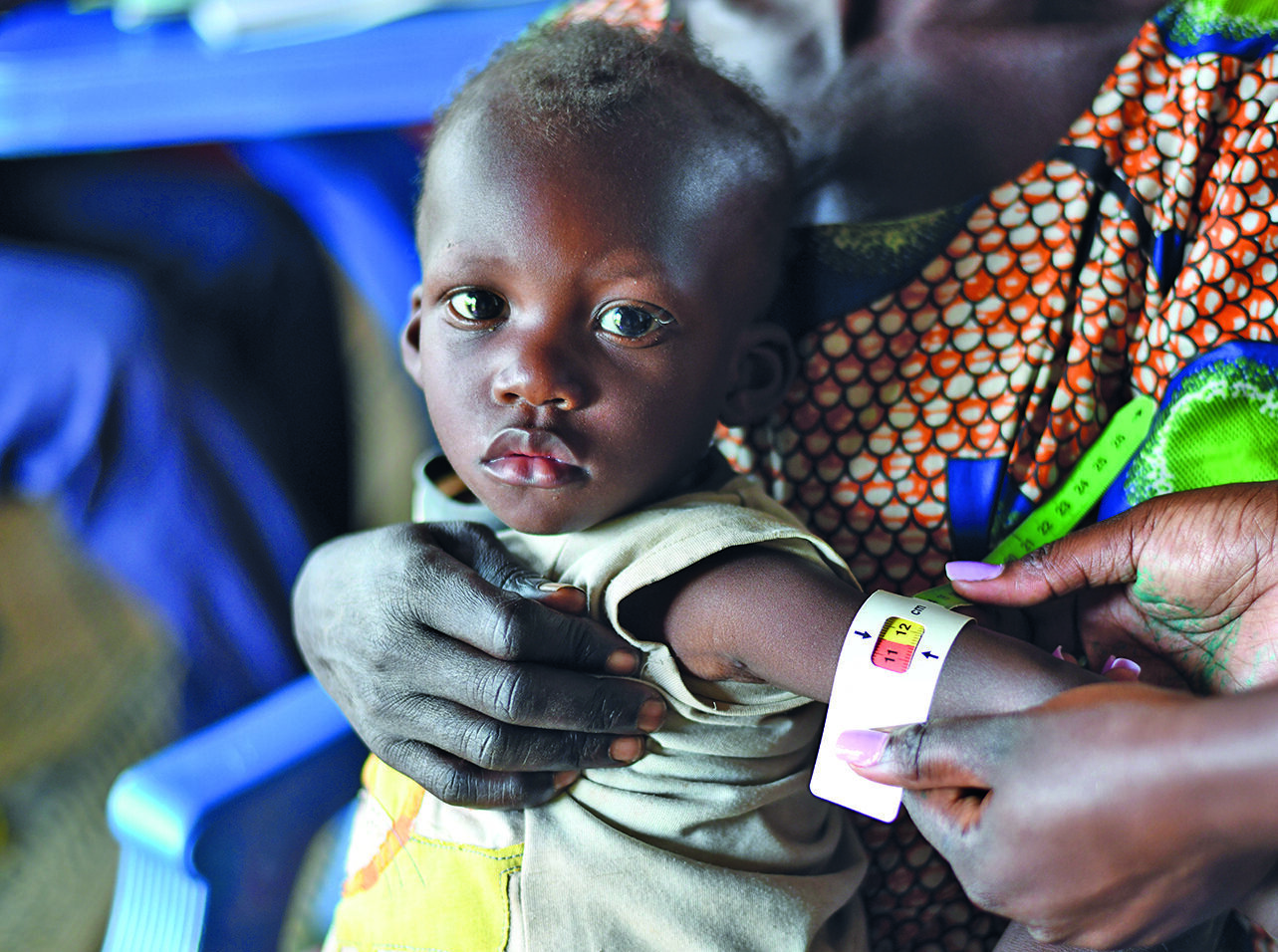 A malnourished child receives treatment - part of the impact work fueled by donations to UNICEF.